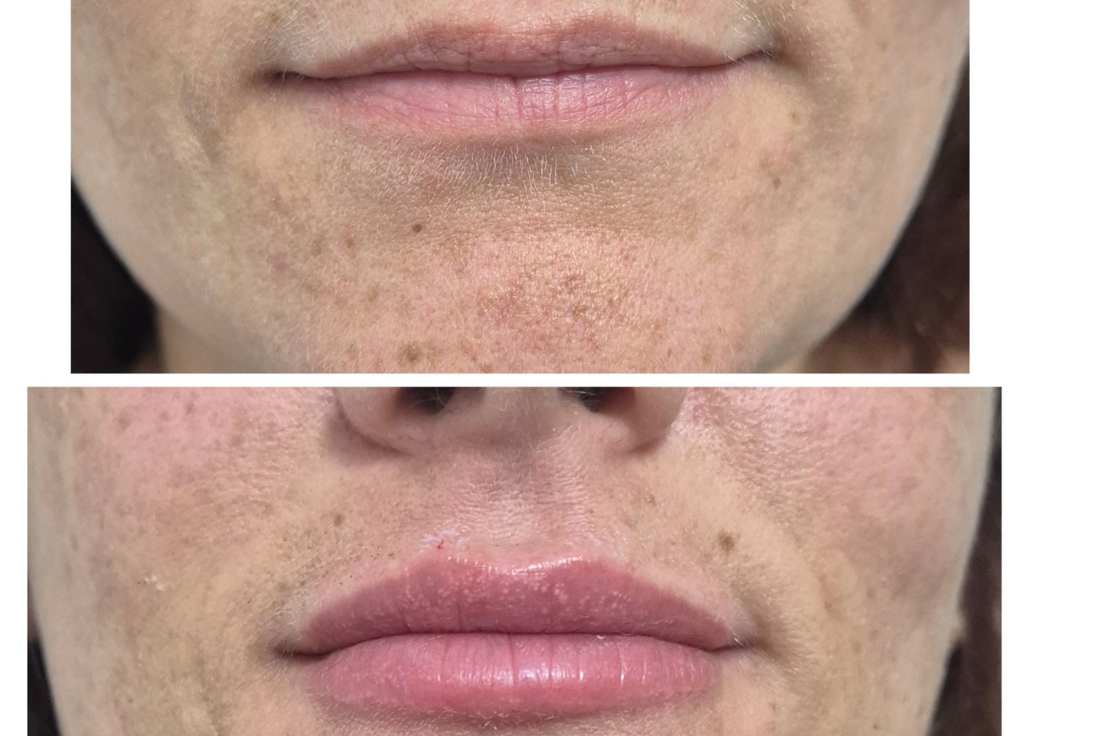 Estética avançada facial corpor